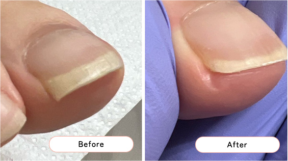 フットケアの様子1