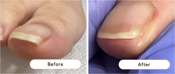 フットケアの様子2