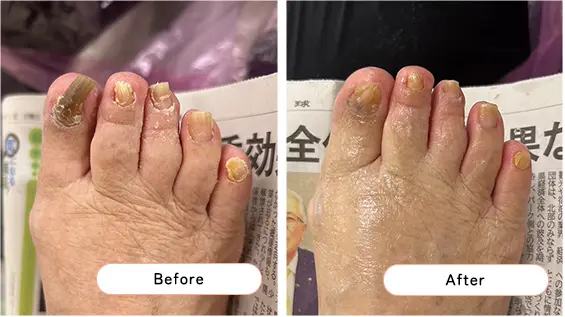 フットケアの様子4